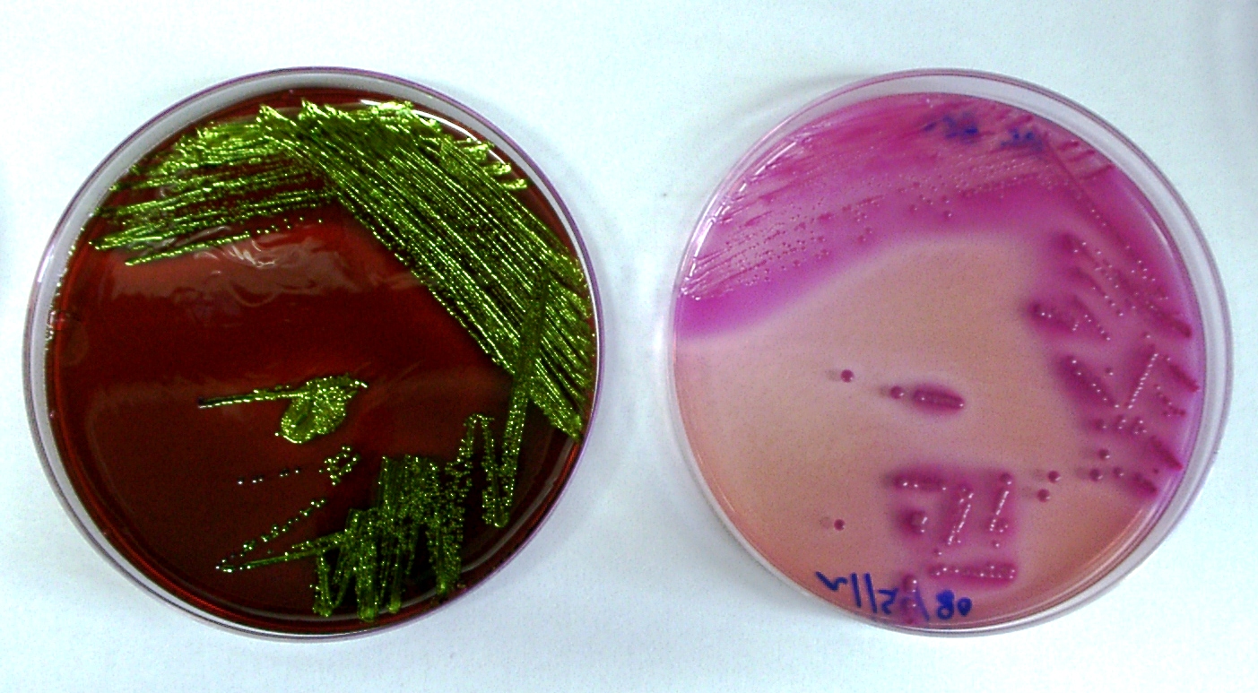 agar emb vs macconkey